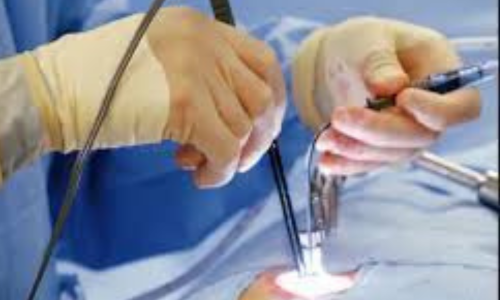 Top Fissure Treatment in Hyderabad