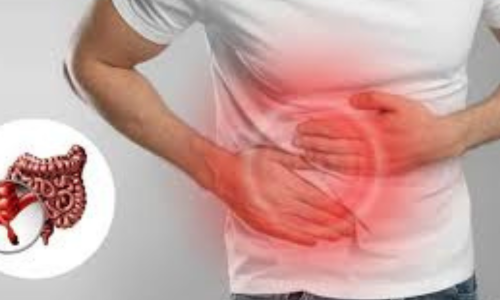 Best Hernia Treatment in Hyderabad