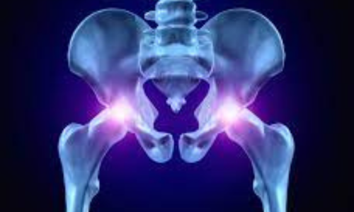 Best Hip Replacement Surgery in Hyderabad