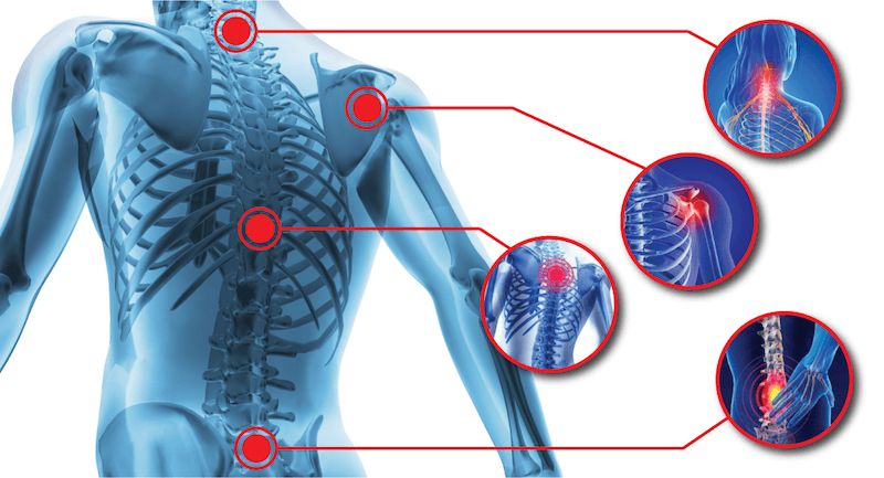 Pain Management