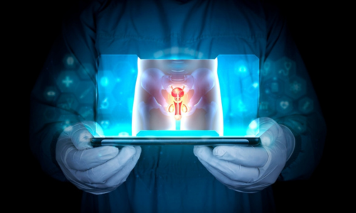 Best Hydrocele Treatment in Hyderabad