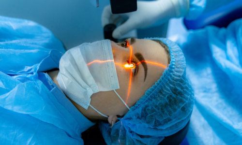 Advanced LASIK Eye Surgery in Hyderabad