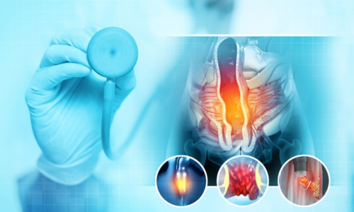 Best Piles Treatment in Hyderabad