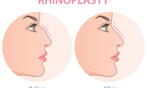 Best Cosmetology Clinic in Hyderabad
