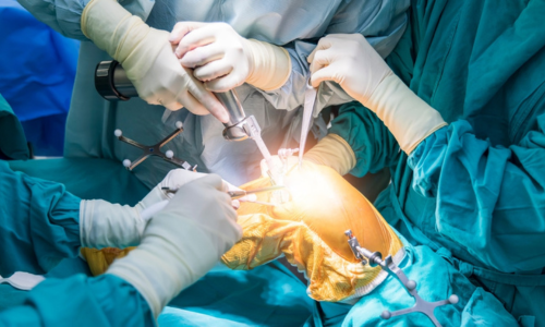 Top 7 Benefits of Choosing Minimally Invasive Surgery