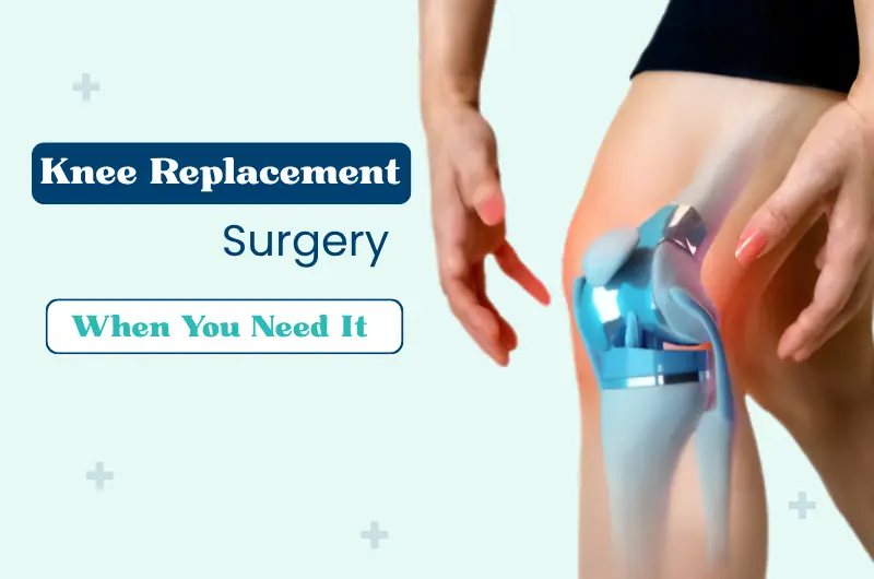 Knee replacement prosthetic implant highlighted showing artificial joint used in knee arthritis surgery performed in Hyderabad hospitals