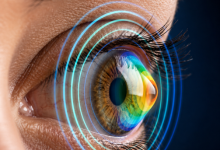 Advanced glaucoma treatment in Hyderabad with eye pressure monitoring and optic nerve protection technology.