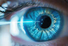 LASIK eye surgery in Hyderabad with precision laser vision correction for clear eyesight without glasses.