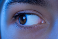 Squint eye surgery in Hyderabad for children and adults with advanced eye alignment correction treatment.
