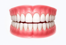 Full mouth rehabilitation treatment in Hyderabad for complete dental restoration and smile reconstruction