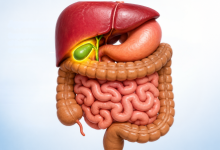 Gallbladder stone surgery in Hyderabad showing gallbladder removal treatment for gallstones