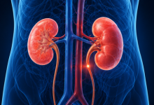 Kidney transplant surgery in Hyderabad showing healthy kidneys and advanced transplant care
