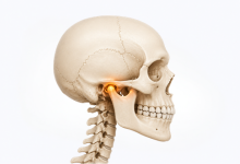 TMJ surgery in Hyderabad for temporomandibular joint disorder and jaw pain treatment