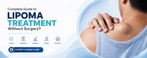 Complete guide to lipoma treatment without surgery in Hyderabad - non-surgical options, cost, and when to choose surgery